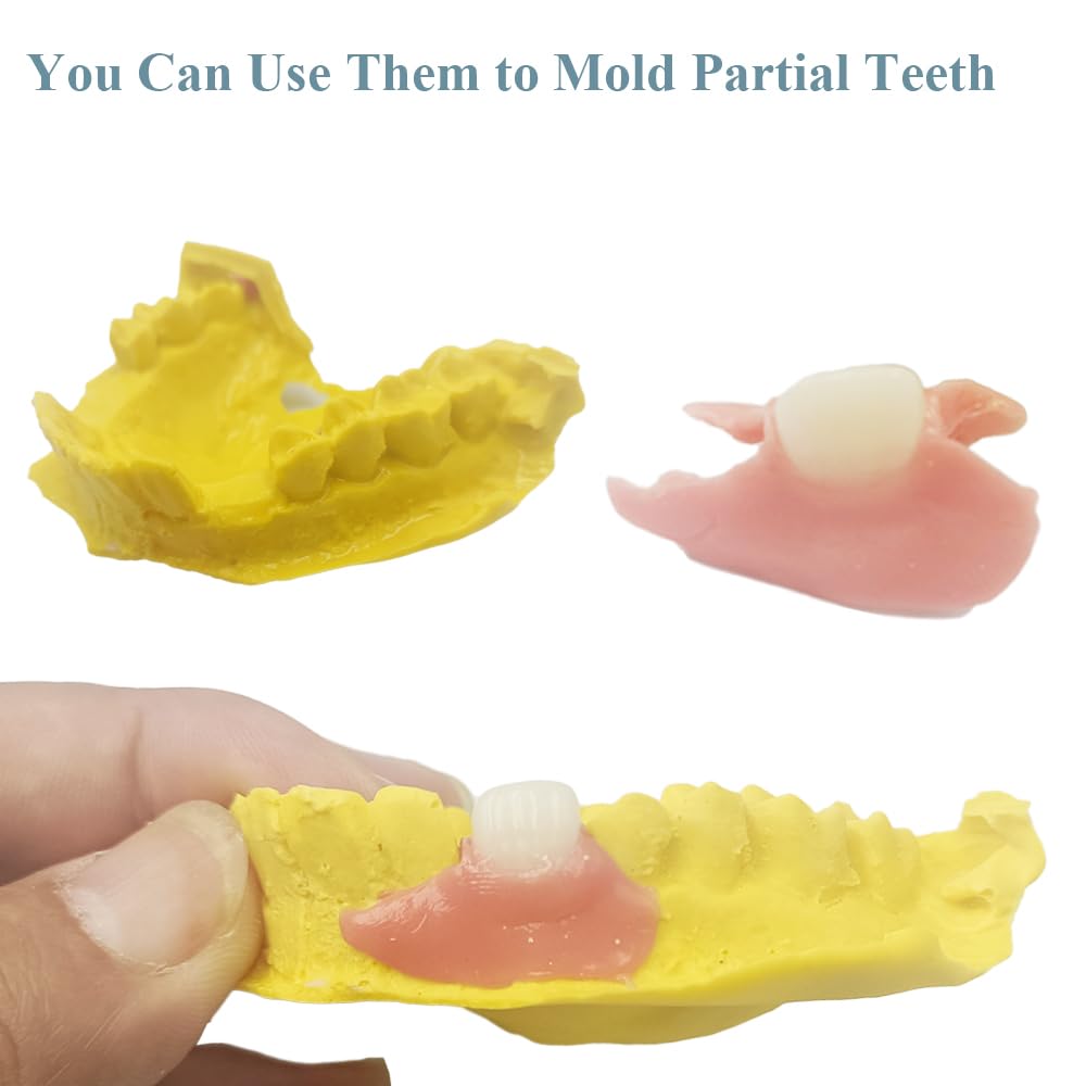 DIY Denture Complete Kit with Impression Material, Gum Material, Components for Top and Bottom Full or Partial Dentures Z531563